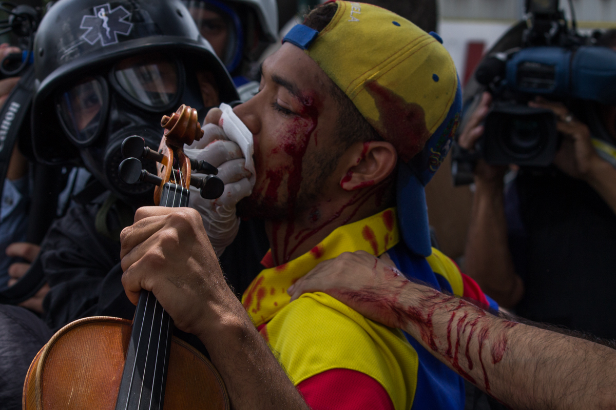 Violinista Wuilly Arteaga, herido con perdigones durante manifestaciones contra Maduro. Foto: Iván Reyes Violinista Wuilly Arteaga, herido con perdigones durante manifestaciones contra Maduro. Foto: Iván Reyes