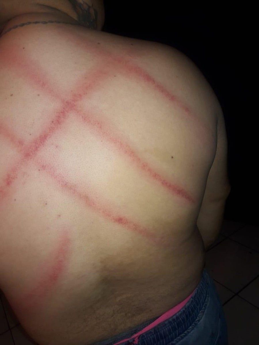 Heridas sufridas por Quilodrán después de golpiza de Gendarmería - Fotografía publicada originalmente en periódico Resumen. Heridas sufridas por Quilodrán después de golpiza de Gendarmería - Fotografía publicada originalmente en periódico Resumen.