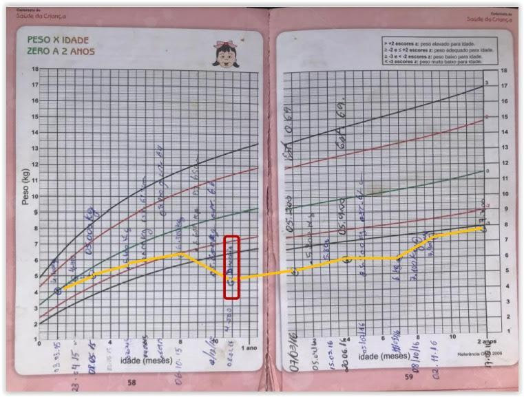 Libreta del niño yanomami: tras un episodio de diarrea en el octavo mes -después del destete- el niño es incapaz de recuperar su peso. Libreta del niño yanomami: tras un episodio de diarrea en el octavo mes -después del destete- el niño es incapaz de recuperar su peso.