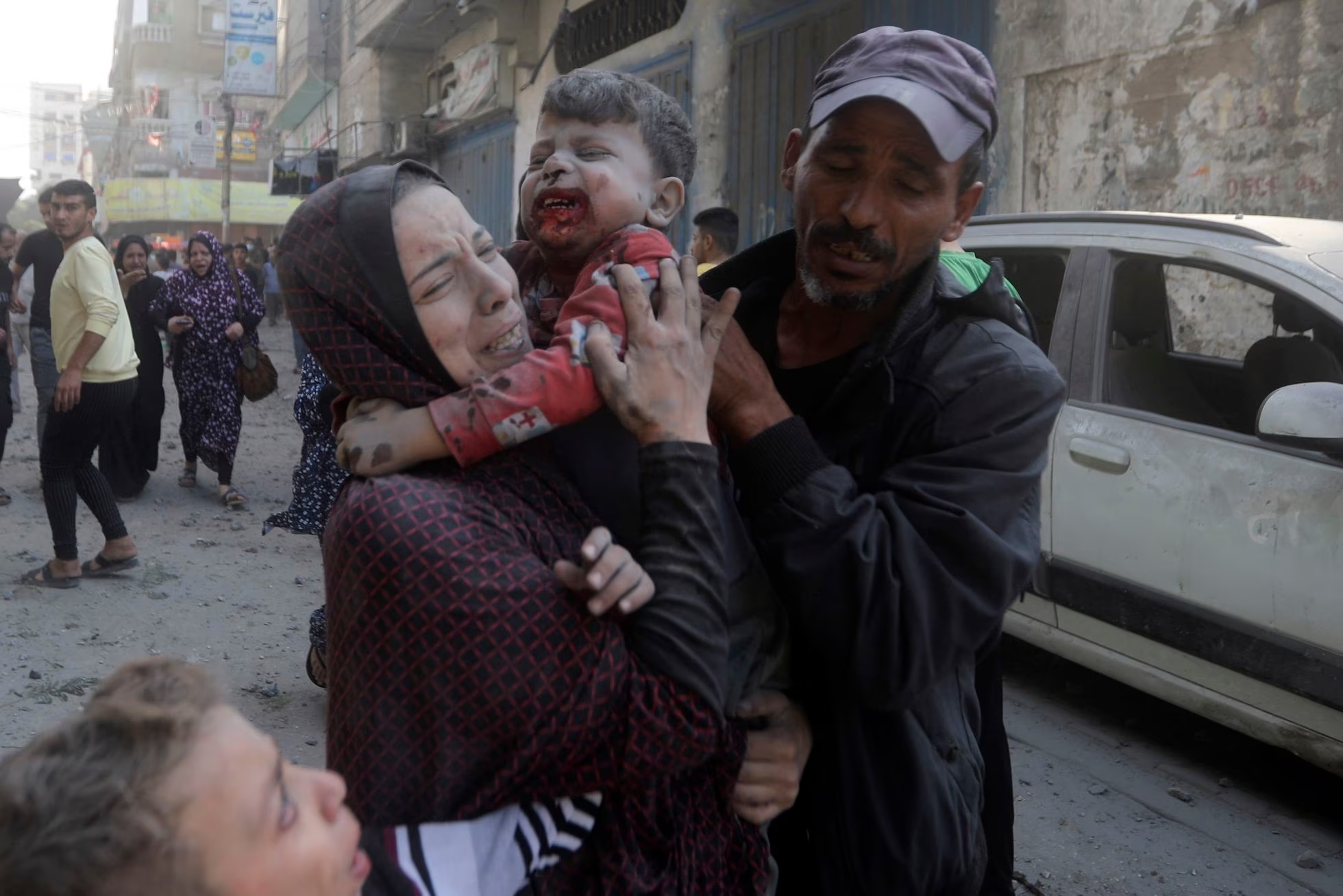 Niño herido en campo de refugiados de Bureij (Mohammed Dahman/Associated Press).