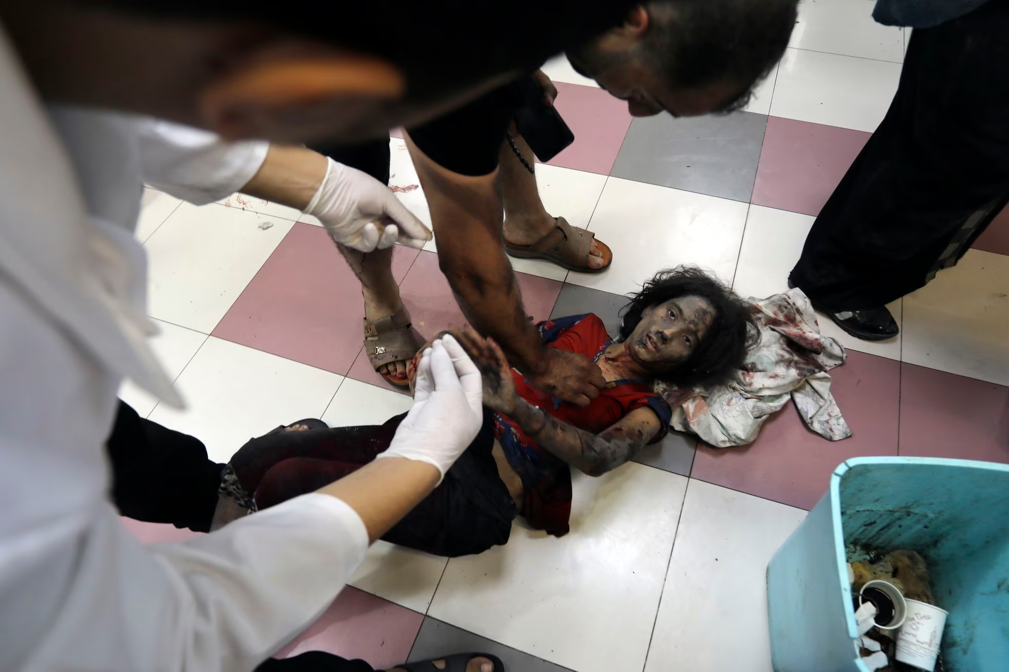 Una niña recibe atención en el hospital de Al Shifa