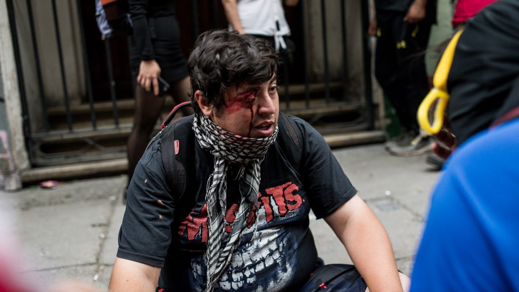 Según el reporte del 30 de noviembre del INDH, existen 241 personas con heridas oculares hasta esa fecha. (Fotografía: Migrar Photo) Según el reporte del 30 de noviembre del INDH, existen 241 personas con heridas oculares hasta esa fecha. (Fotografía: Migrar Photo)